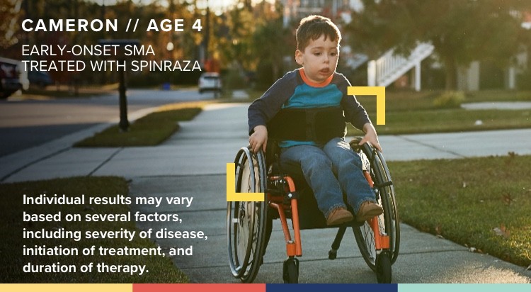 a child with early-onset SMA who is being treated with SPINRAZA